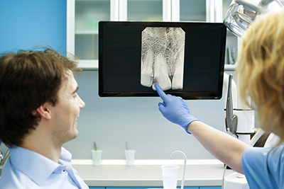 Do X-rays Improve Your Oral Health? Of Course, They Do!