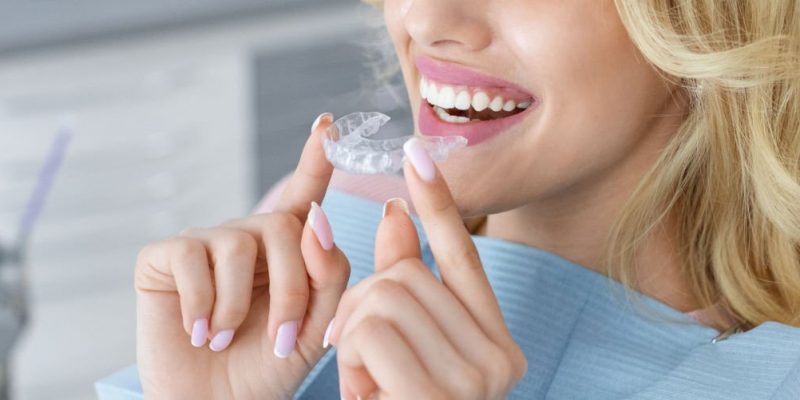 Simple Steps to Know How Invisalign Aligners Work