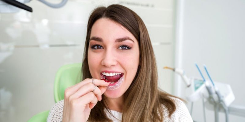 How To Find The Best Orthodontist For Invisalign