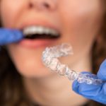 Pros & Cons Of Invisalign Braces Treatment