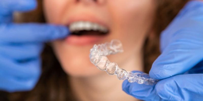 Pros & Cons Of Invisalign Braces Treatment