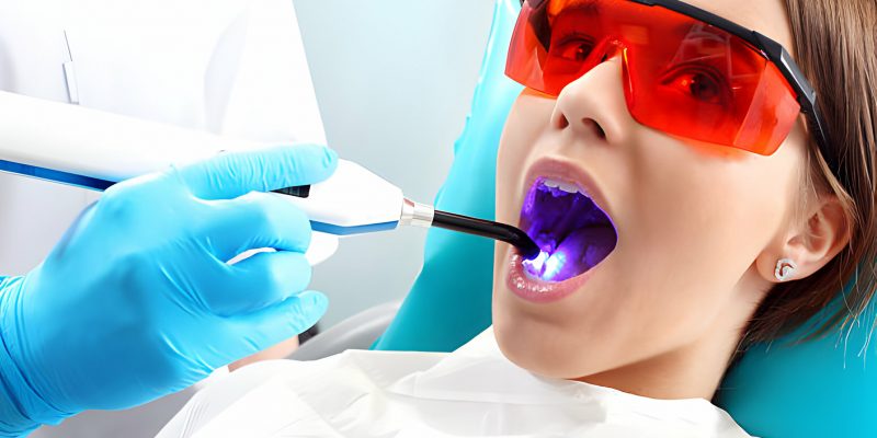 Root Canal Tooth Removal: Is It Painful? Essential Facts To Know_FI