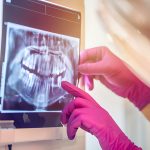 Different Types of X-Rays by Dental Summerville, SC_FI