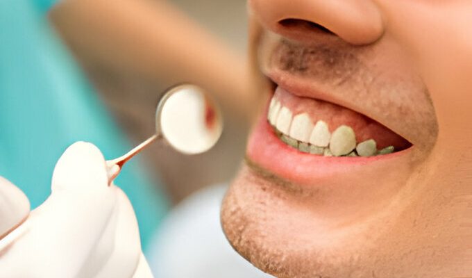Busting Myths About Dental Cleanings_FI