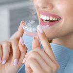 Maintaining Your Invisalign Aligners: Tips for Summerville Residents to Keep Their Smile Sparkling