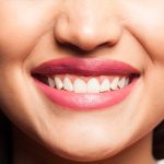 Professional Teeth Whitening in Summerville, SC – Why Patients Trust Cane Bay Family Dentistry_FI