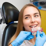 Dental Veneers in Summerville, SC: Natural-Looking Results at Cane Bay Family Dentistry_FI