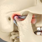 How TMJ Disorders Affect Daily Life - Insights from a Summerville, SC Dentist_FI